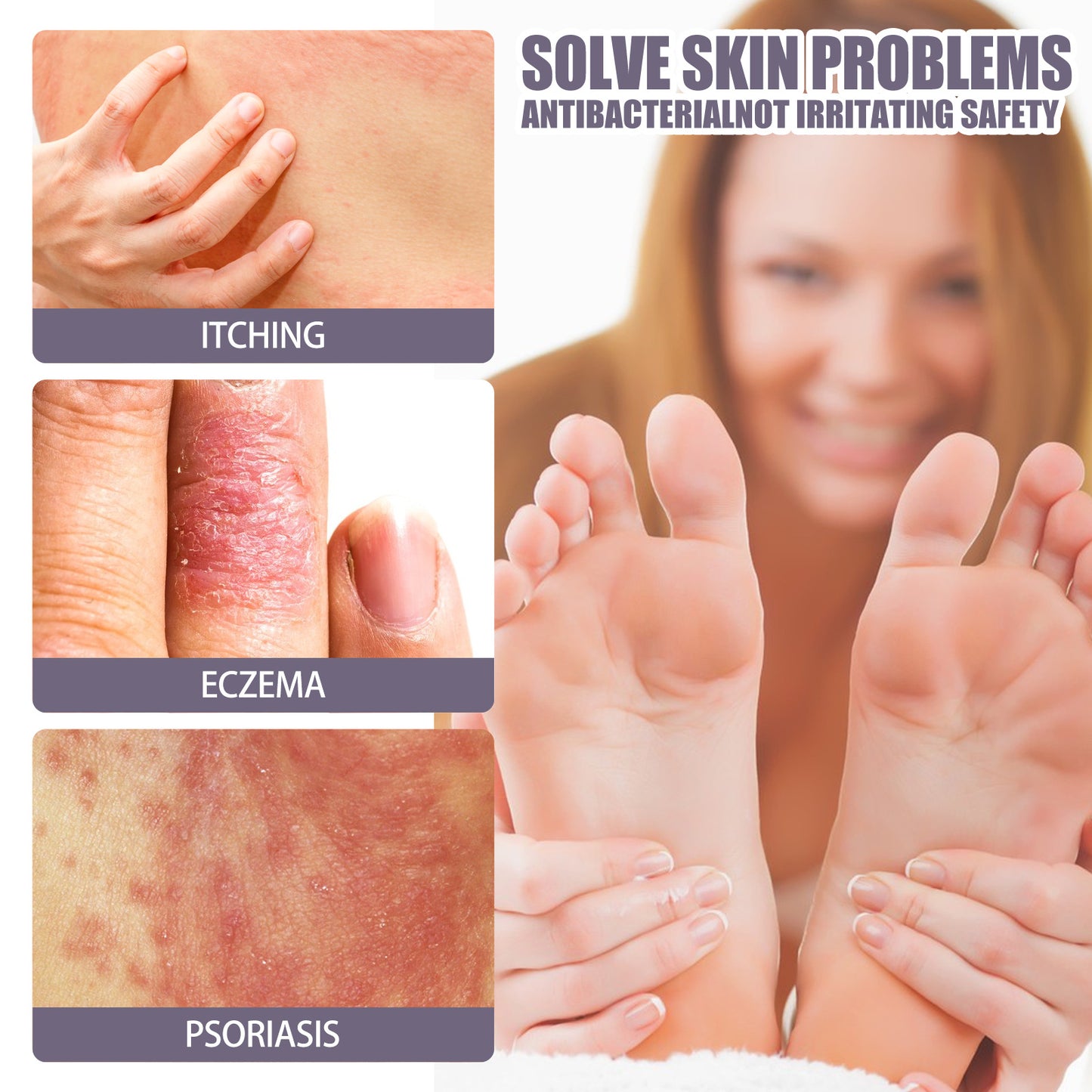 EELHOE Eczema, Psoriasis, and Itch Relief Moisturizing  Natural Care Spray