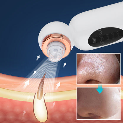 Dispositivo eléctrico para puntos negros, acné y limpieza facial