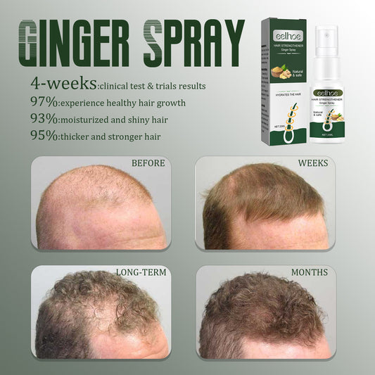 EELHOE Ginger Dense Hair Spray - Nourishing Hair Follicle & Anti-Hair Loss Treatment