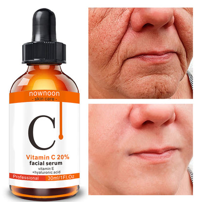 NOVNOON Suero facial hidratante antienvejecimiento con vitamina C 30 ml