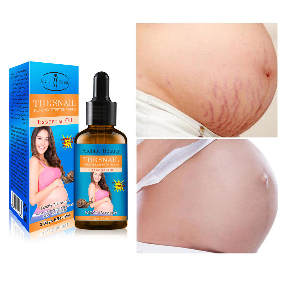 AICHUN BEAUTY Snail Belly Fade Lines Massage Oil