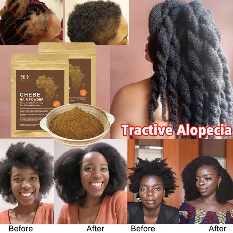 SEVICH Chebe Powder - African Hair Growth, Strengthening, and Anti-Hair Loss Treatment