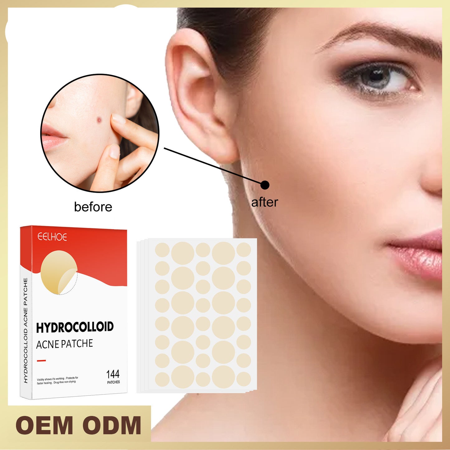 EELHOE Hydrocolloid Invisible Makeup Applicable Acne Patch -144 Pieces