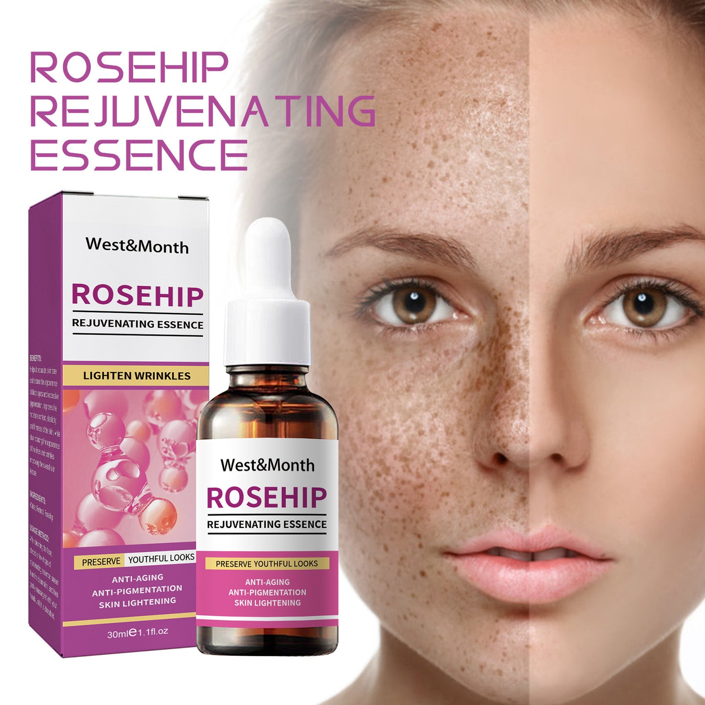 Rose Fruit Skin Rejuvenation Moisturizing Freckle and Spot Remover Toner