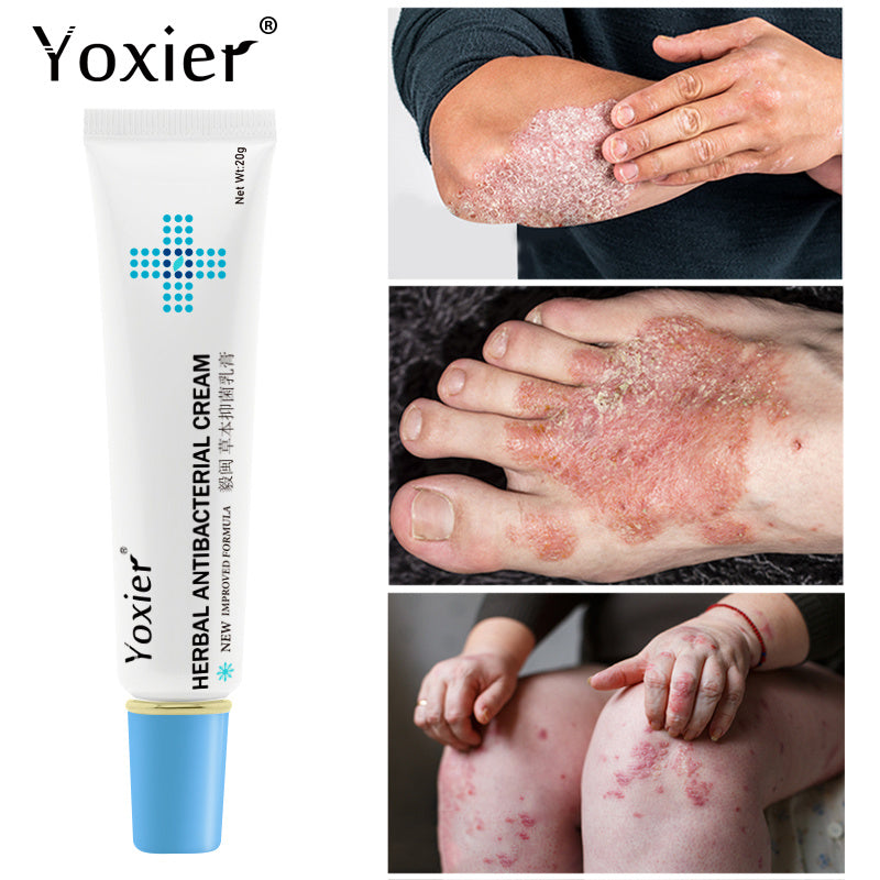 YOXIER Herbal Antibacterial Cream for Psoriasis, Eczema, and Dermatitis – Herbal Care Cream for Itching, Redness, and Peeling