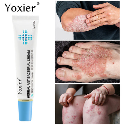 Crema antibacteriana a base de hierbas YOXIER para psoriasis, eczema y dermatitis: crema a base de hierbas para el cuidado de la picazón, el enrojecimiento y la descamación