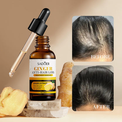 SADOER Aceite para el tratamiento del cabello con jengibre: fórmula anticaída del cabello