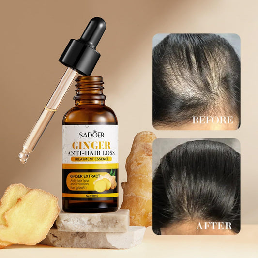 SADOER Ginger Hair Treatment Oil - Anti-Hair Loss Formula