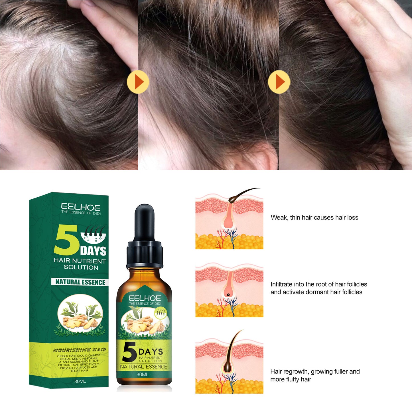 EELHOE Ginger Hair Care Essential Oil - Anti-Hair Loss Treatment