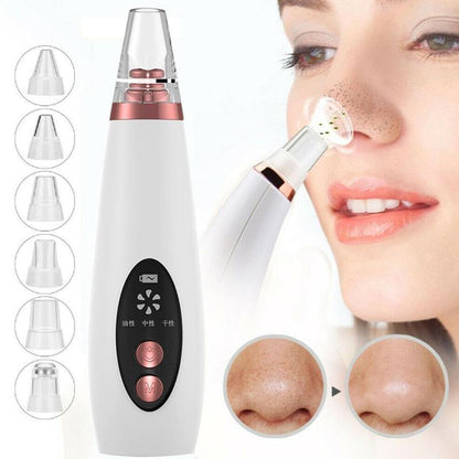 Aspirateur de pores pour points noirs, nettoyant, produit de soin du nez, éliminateur d'acné, outil de soin de la peau beauté