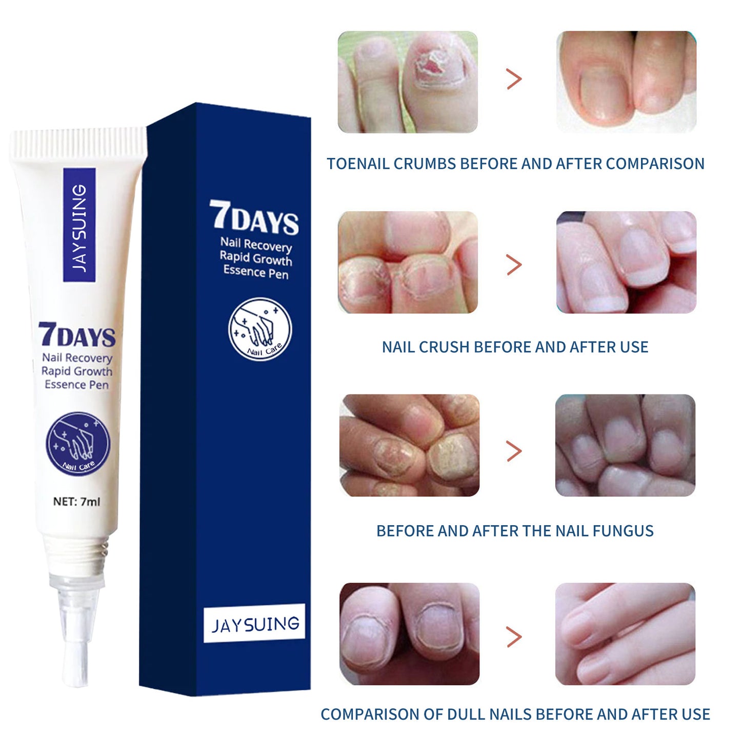 JAYSUING 7 Days Nail and Hand Foot Care