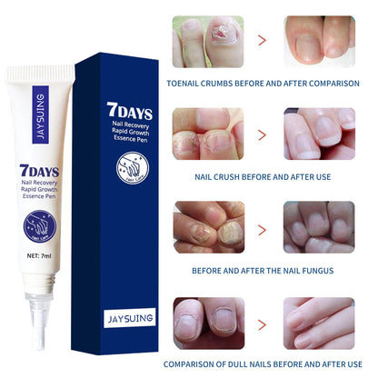 JAYSUING 7 Days Nail and Hand Foot Care