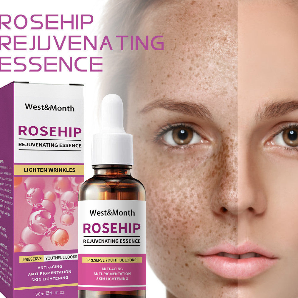 Rose Fruit Skin Rejuvenation Moisturizing Freckle and Spot Remover Toner