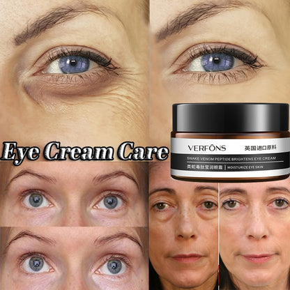 VERFONS Firming and Moisturizing Eye Cream - Anti-Fine Lines and Dark Circles, Moisturizing Eye Mask Cream