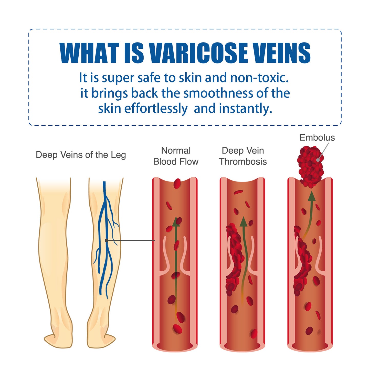 Intravenous Massage Cream Relieves Vascular Leg Massage Treatment and Laser Pointer