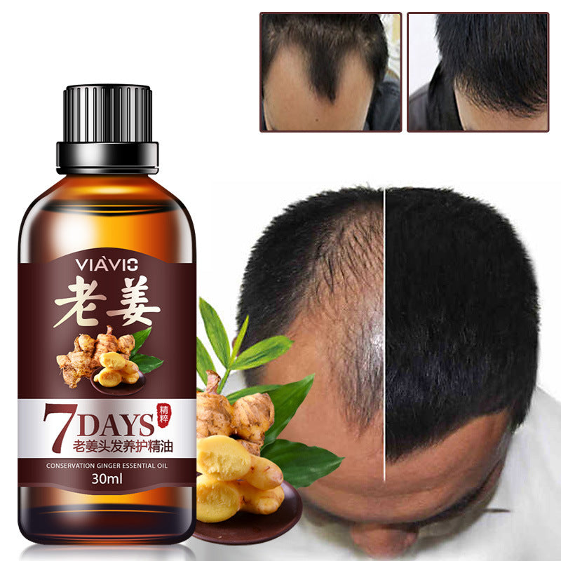 DAGEDA New Ginger Hair Growth Oil Essence, detiene la caída del cabello, espesa el cabello, trata la calvicie y favorece el crecimiento saludable del cabello para mujeres y hombres, 30 ml: compre 3 y pague 2