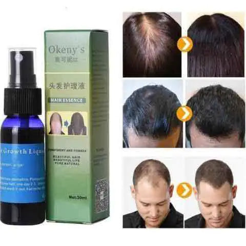 OKENYS Organic Hair Growth Essence